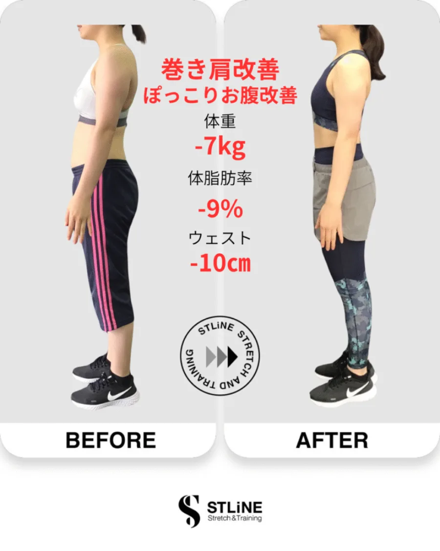 お客様のビフォーアフター（巻き肩改善・ぽっこりお腹改善／体重 -7kg / 体脂肪率 -9% / ウエスト -10cm）