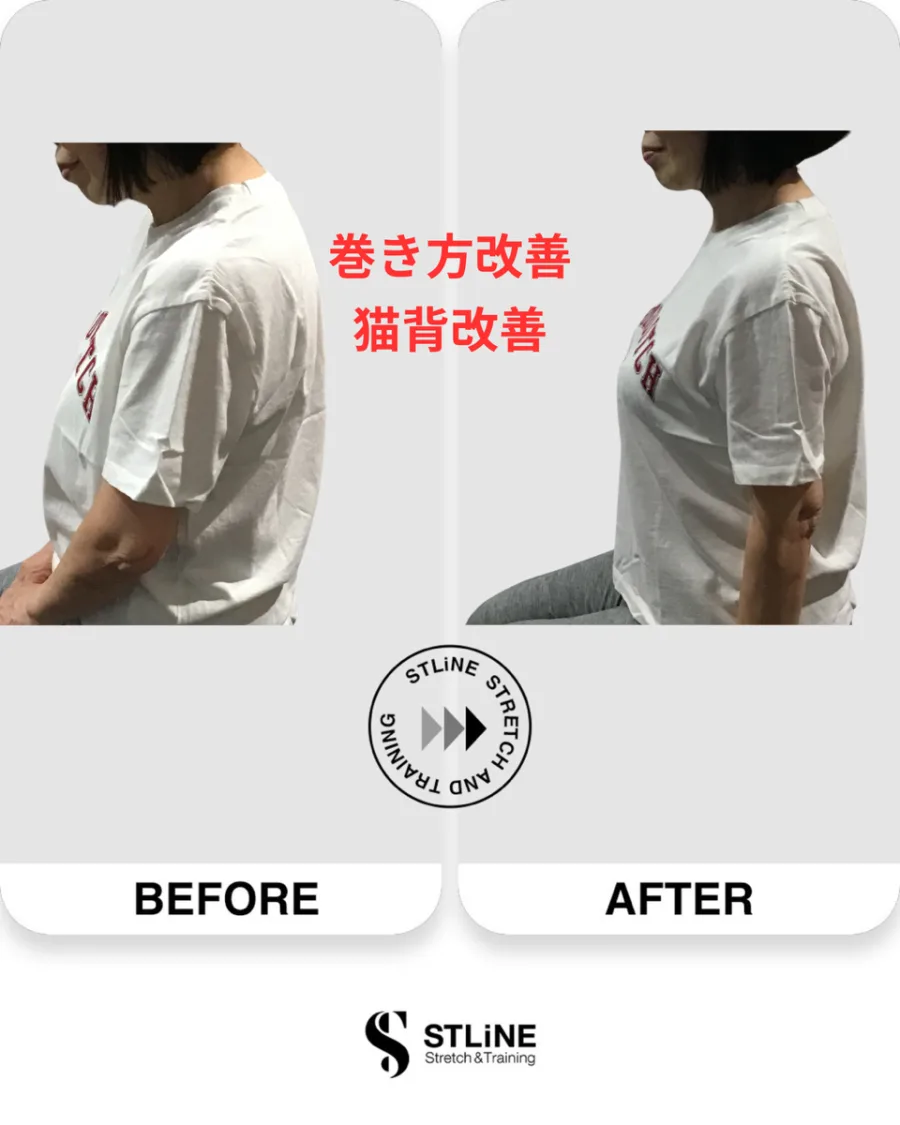 お客様のビフォーアフター（巻き肩改善・猫背改善）